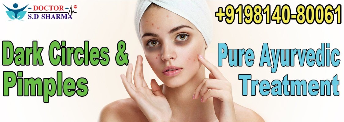 Dark Circles Pimples ayurvedic treatment